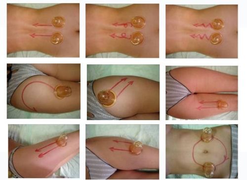 fungerar koppning mot celluliter